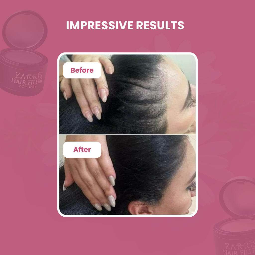 Zarris™ Hair Filler Powder